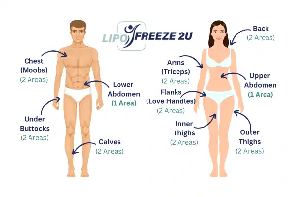 Areas you can have fat freezing treatment Northamptonshire