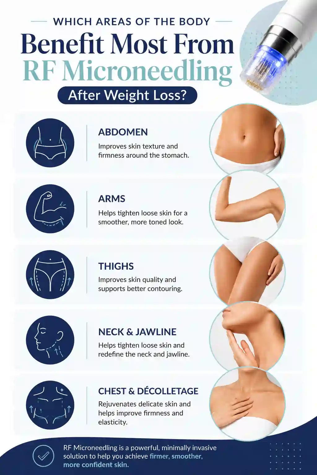 Which Areas of the Body Benefit Most From RF Microneedling After Weight Loss Northamptonshire
